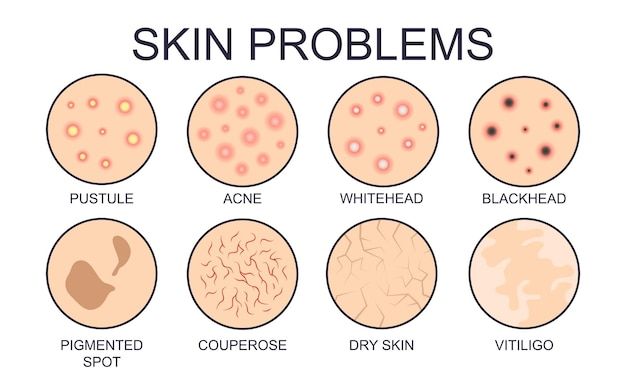 Maintaining proper hygiene is the foundation of preventing and managing skin infections.